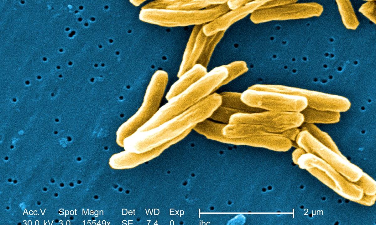 Marine Plants Could Potentially Cure TB - picture 1