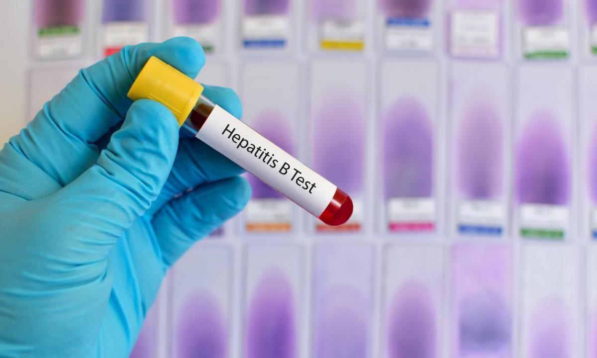 Длительность воздействия антигена HBsAg влияет на иммунный ответ при ХГВ - изображение 1 Длительность воздействия антигена HBsAg влияет на иммунный ответ при ХГВ - изображение 1