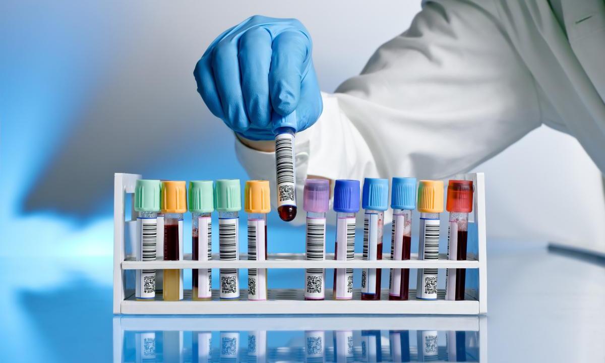 PHE: Великобритания сможет сократить число новых случаев ВИЧ до нуля к 2030 году PHE: Великобритания сможет сократить число новых случаев ВИЧ до нуля к 2030 году
