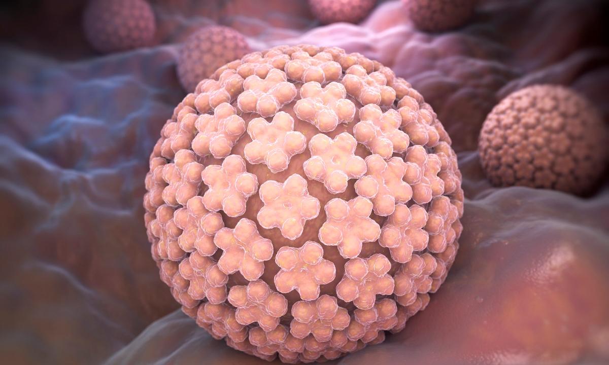 HPV Causes Pre-Cancerous Cervical Lesion More Often By HIV-positive Women - picture 1 HPV Causes Pre-Cancerous Cervical Lesion More Often By HIV-positive Women - picture 1