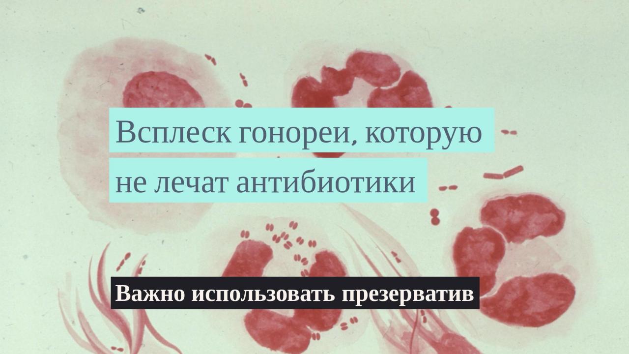 ВОЗ предупреждает о всплеске случаев гонореи, устойчивой к антибиотикам - изображение 1 ВОЗ предупреждает о всплеске случаев гонореи, устойчивой к антибиотикам - изображение 1