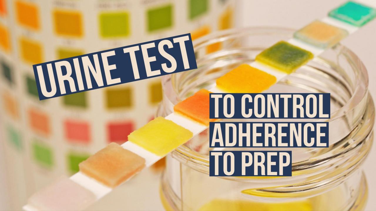 UPenn Researchers Developed an Urine Test for Tenofovir to Monitor Adherence among people on PrEP - picture 1 UPenn Researchers Developed an Urine Test for Tenofovir to Monitor Adherence among people on PrEP - picture 1