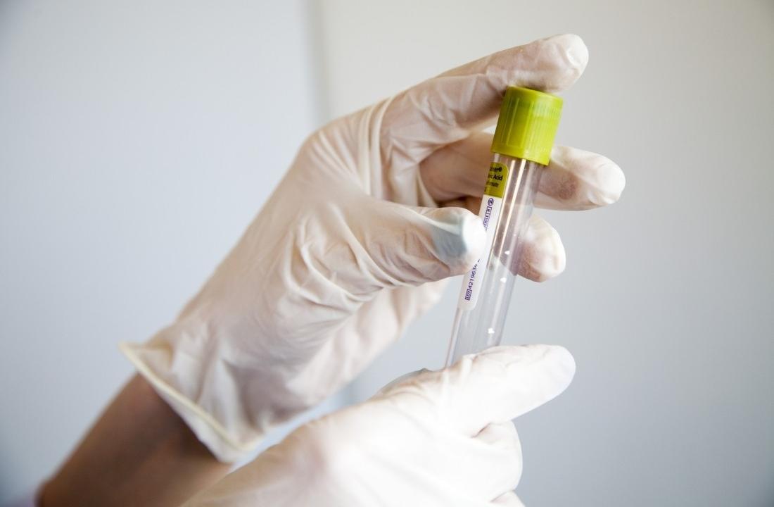 Spanish scientists told about promising results of HIV suppression in stem cell transplantation - picture 1 Spanish scientists told about promising results of HIV suppression in stem cell transplantation - picture 1