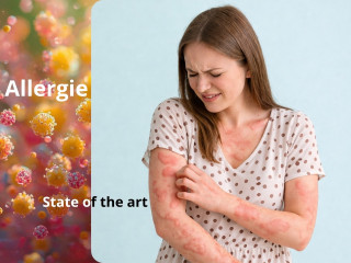 Allergie - State of the art