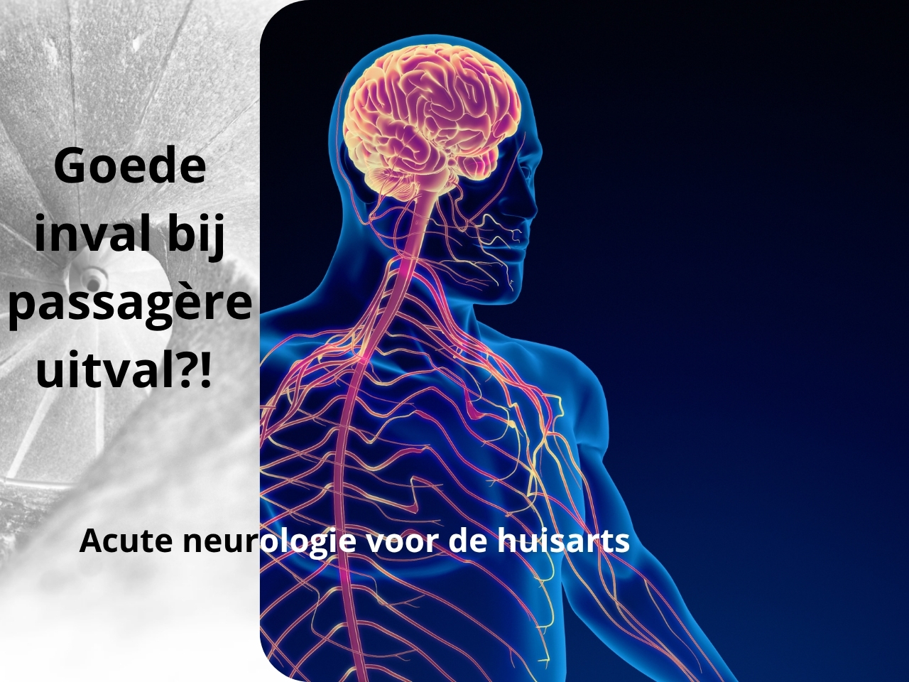 Goede inval bij passagère uitval?! Acute neurologie voor de huisarts