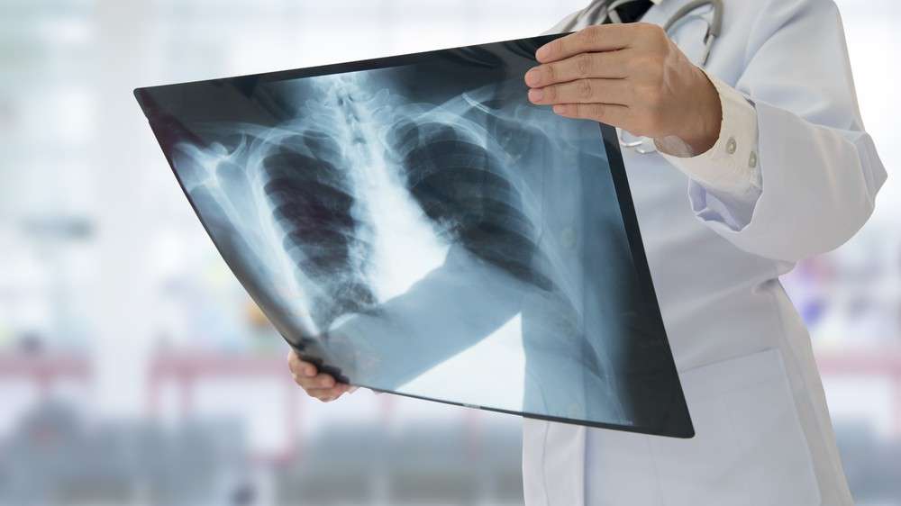 Wat is tuberculose? Wat is tuberculose?