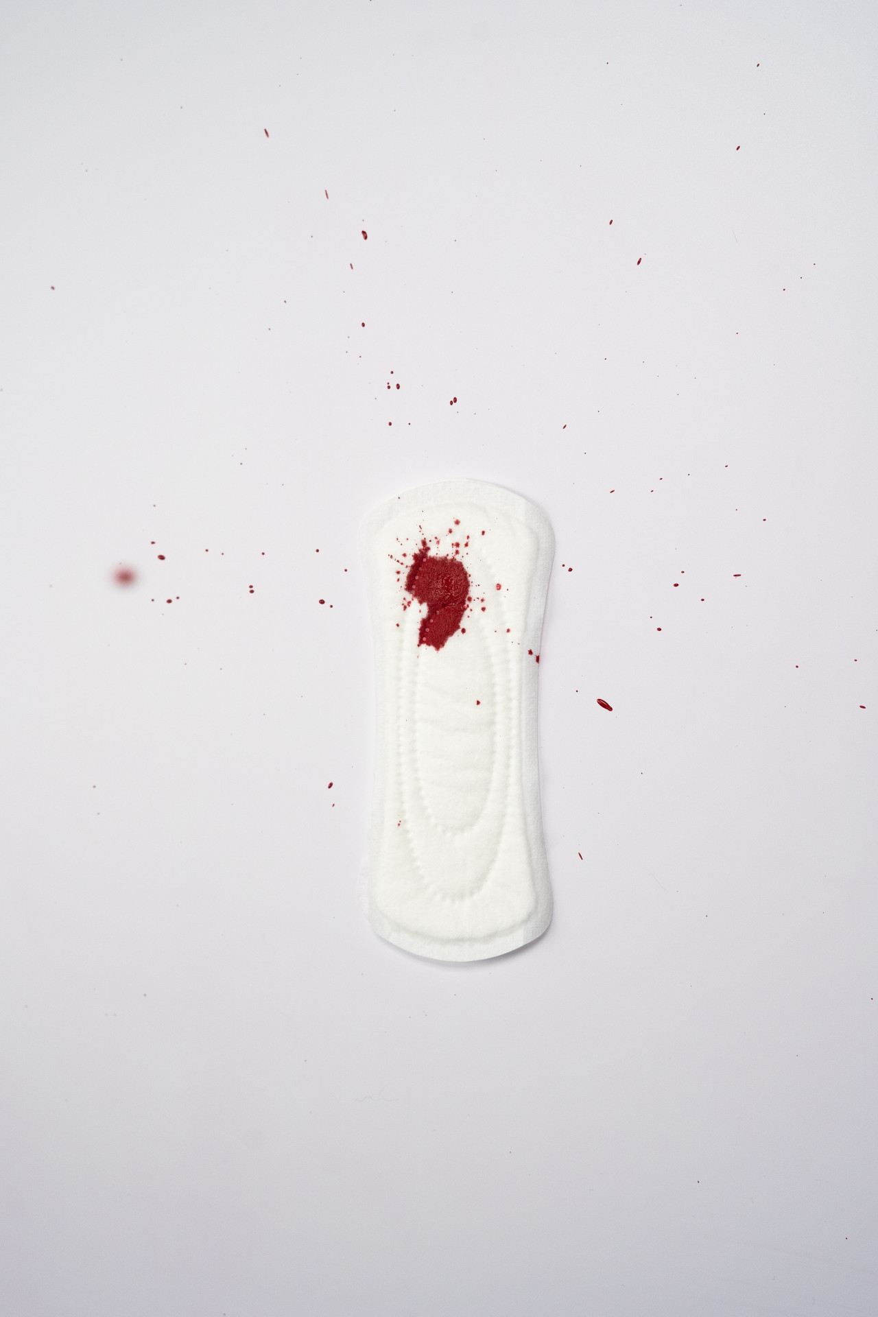 Endometriose: meer dan pijnlijke menstruatie Endometriose: meer dan pijnlijke menstruatie