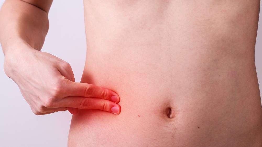 Wat is blindedarmontsteking of appendicitis? Wat is blindedarmontsteking of appendicitis?
