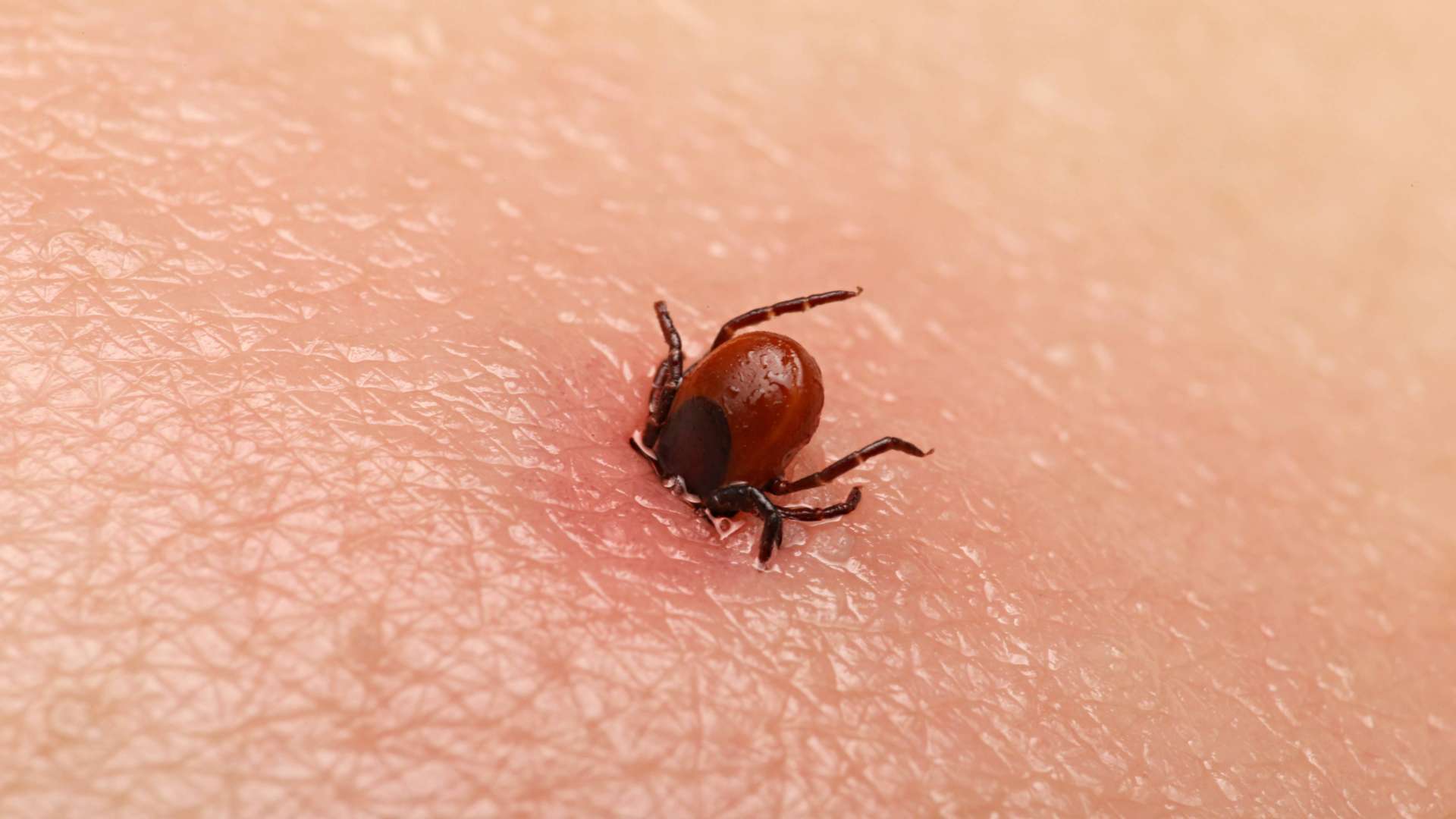 Wat is de ziekte van Lyme? Wat is de ziekte van Lyme?