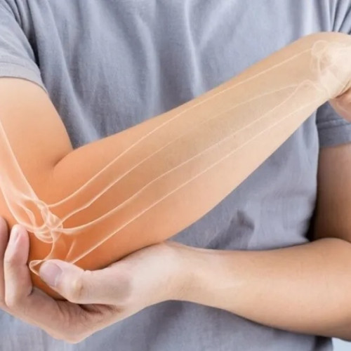 Sorina Popa din Suceava suferă de dureri severe la cot