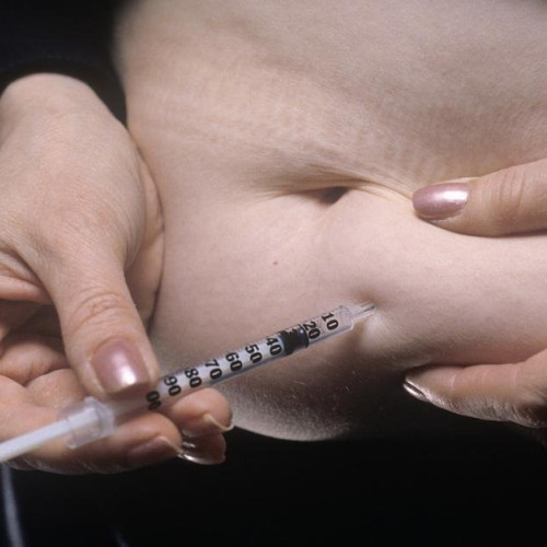 Descoperire medicală importantă pentru tratamentul diabetului zaharat de tip 2