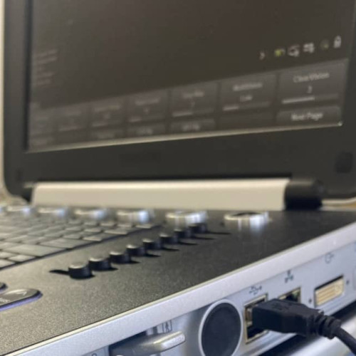 Ecografe de înaltă performanță pentru Spitalul din Alba Iulia