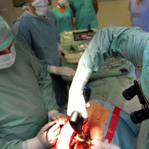 Un bărbat a primit o inimă din titan, o premieră în lumea medicală