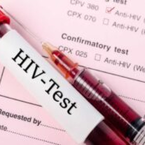 Un nou tratament anti-HIV oferă protecție completă femeilor tinere