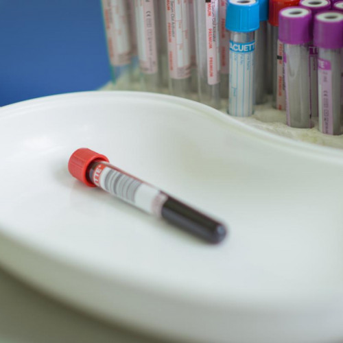 Screeningul pentru infectii cu transmitere sexuala, o prioritate de sanatate publica