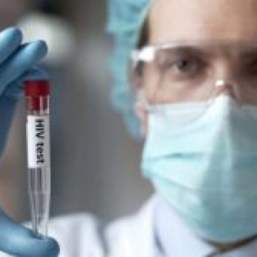 Sute de botosăneni infectați cu virusul HIV-SIDA