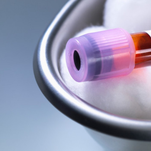 Cercetători din Suedia și Danemarca dezvoltă sânge universal prin eliminarea antigenelor A și B