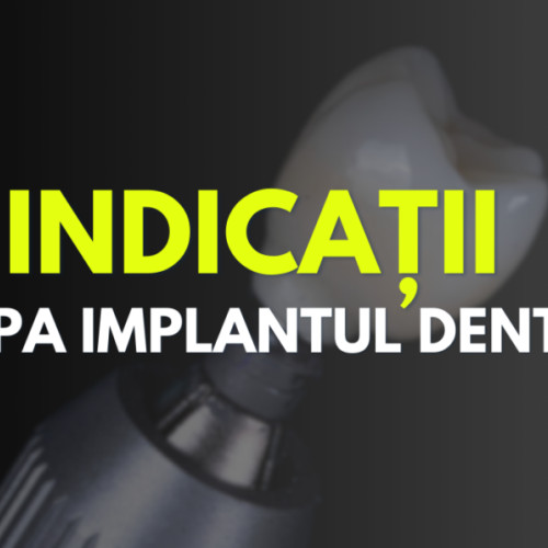 Importanța implanturilor dentare pentru sănătatea orală