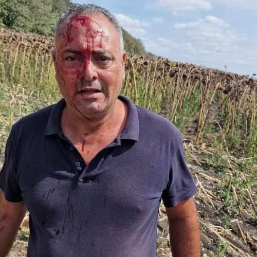 Fermier bătut cu băț de viceprimar în Botoșani