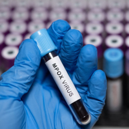 OMS aprobă primul test rapid pentru diagnosticarea mpox