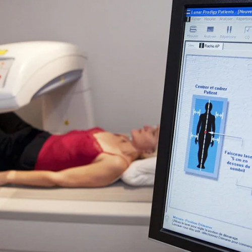 Osteoporoza, o problemă majoră de sănătate publică