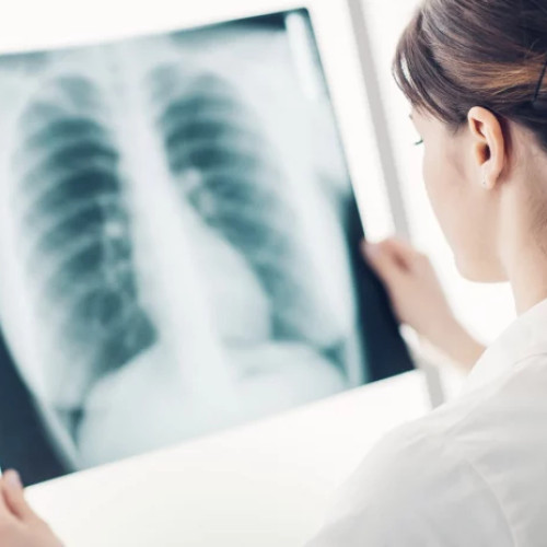 Peste 80 de botoșăneni internați din cauza pneumoniei și virozelor