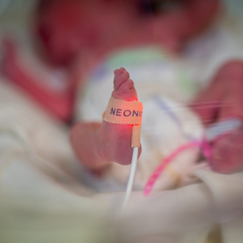 Record la Botoșani: O fetiță prematură cântărește doar 660 de grame