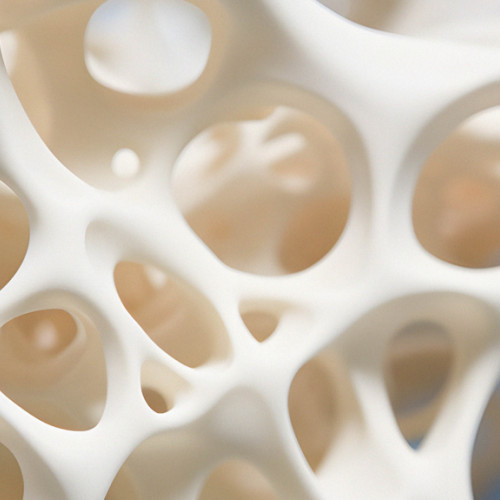 Osteoporoza: O afecțiune care afectează sănătatea oaselor