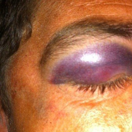 Violența domestică afectează aproape 300 de bărbați din județul Botoșani în 2024