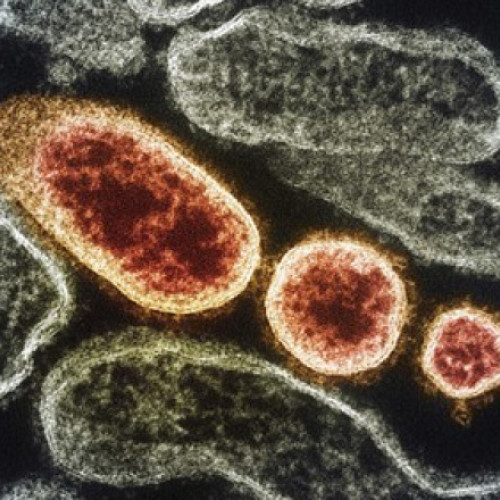 Uniunea Europeană monitorizează o nouă boală în Republica Democratică Congo