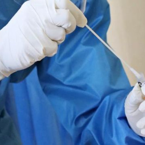 Direcția de Sănătate Publică Botoșani alertează asupra riscurilor bolii X