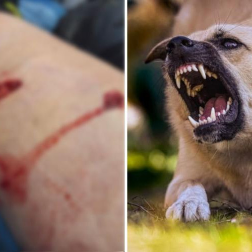 Clujeancă atacată de o haită de câini în Florești