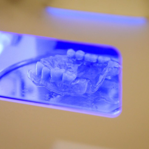 Protezele cu capse suportate de implanturi, o soluție modernă în stomatologie