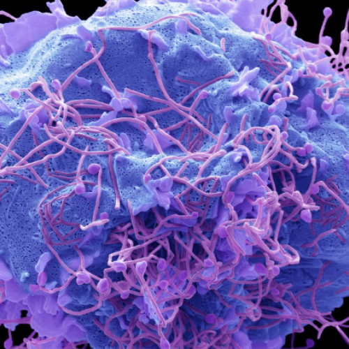 Ingrijorare pentru metapneumovirusul uman (HMPV) în China și în întreaga lume