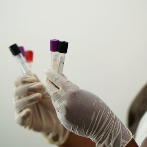 Analize medicale gratuite la Centrul de Sănătate „Sfântul Nectarie”