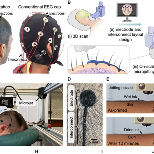 O nouă tehnologie revoluționară pentru monitorizarea activității cerebrale