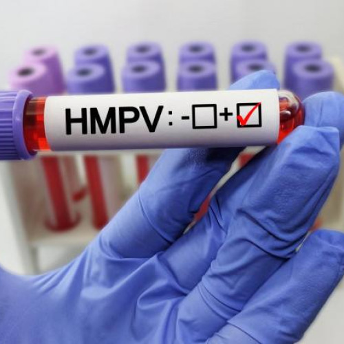 Două cazuri de HMPV confirmate în România, iar un altul e în validare