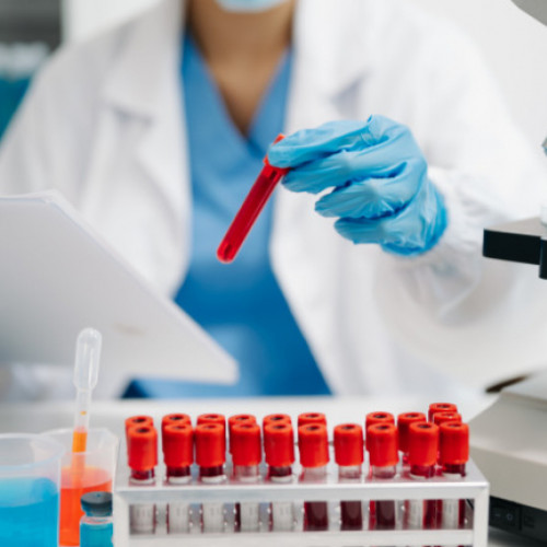 Un nou test de sânge poate detecta cancerul în stadii incipiente