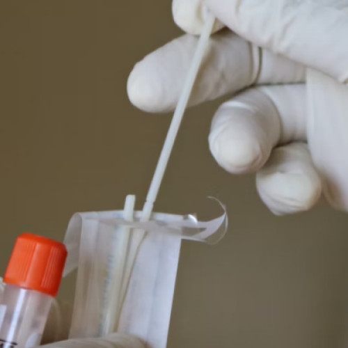 Femeile pot beneficia de testare gratuită Babeș-Papanicolau și HPV la Institutul Oncologic "Prof. Dr. Ion Chiricuță" Cluj-Napoca