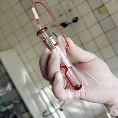 Campanie de screening gratuit pentru hepatita virală B și C în Harghita