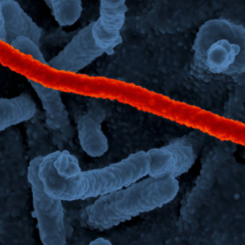 Focar de Ebola confirmat în Kampala, Uganda