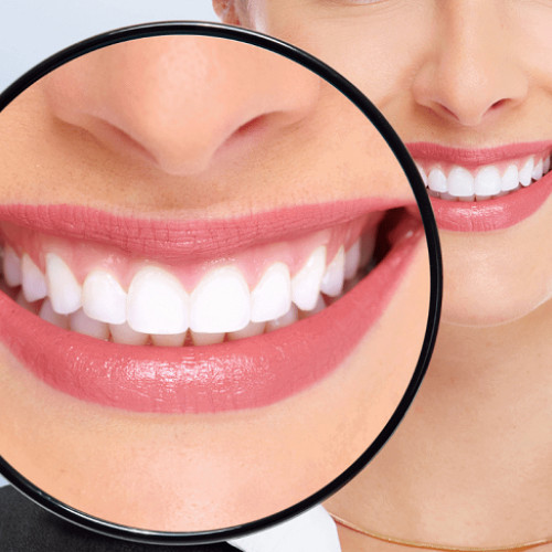 Cum să-ți albești dinții în mod natural cu remedii la îndemână