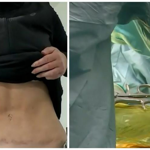 Femeie din Râmnic, plângere la Poliție împotriva chirurgului estetic din Cluj