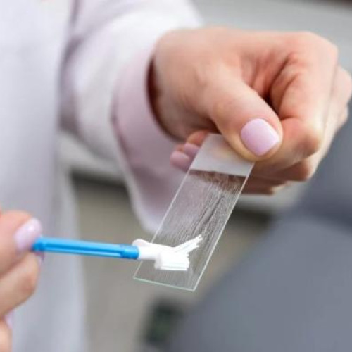 Testări gratuite pentru Babes-Papanicolau și HPV la Institutul Oncologic din Cluj-Napoca