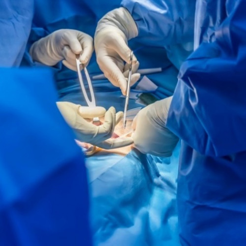 Bărbat din Galați, vindecat de cancer la vezică cu ajutorul robotului Da Vinci