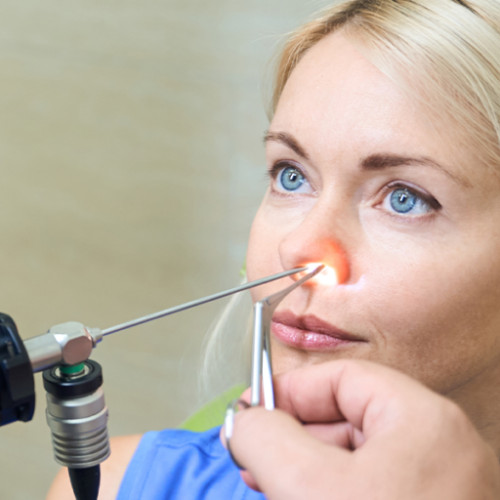 Fibroscopia, o procedură modernă pentru diagnosticarea afecțiunilor ORL