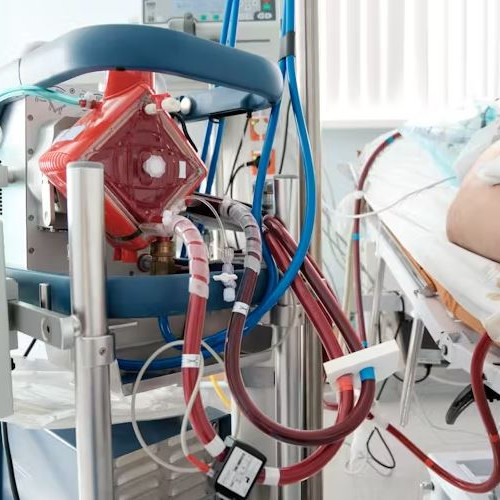 O metodă revoluționară de resuscitare prin oxigenare extracorporală