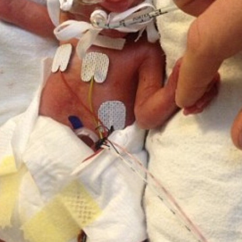 Bebeluș de o lună transportat de urgență la Iași cu elicopterul SMURD