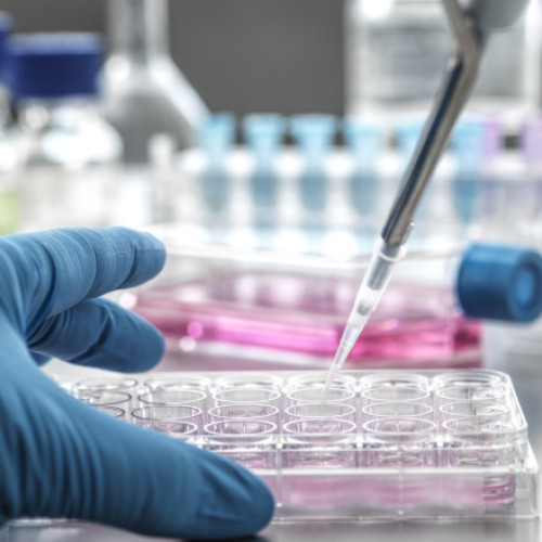 Ancheta la Spitalul Județean Slatina din cauza reactivilor expirați