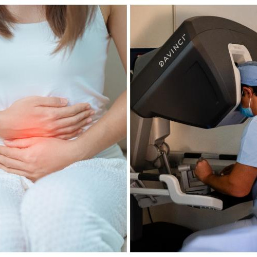 Endometrioza: O Afecțiune Ginecologică Care Necesită O Abordare Multidisciplinară